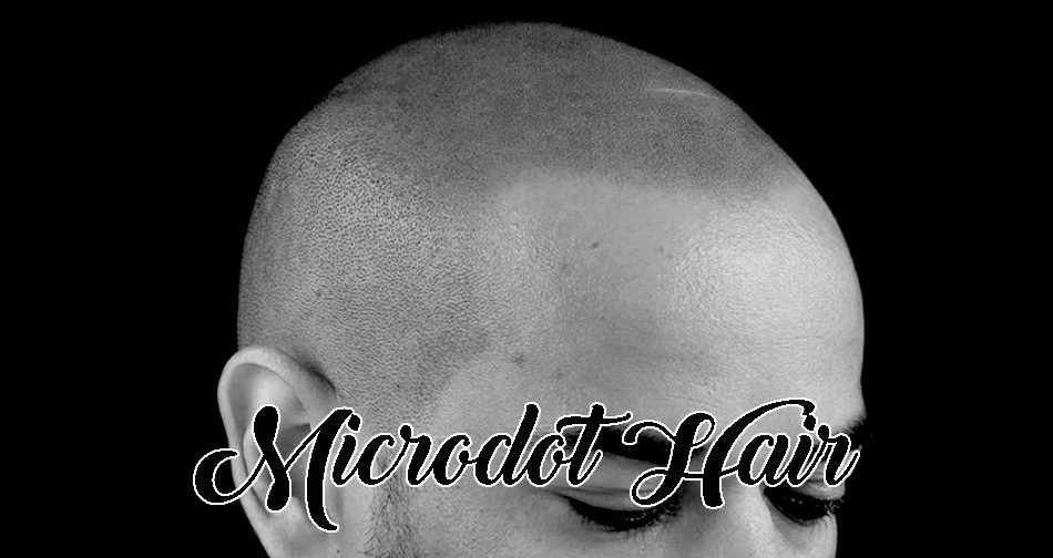 Microdot scalp pigmentation example